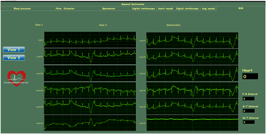 ecg.png