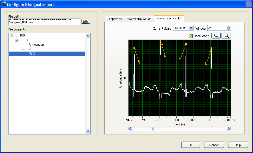 blog_ecg_1.png