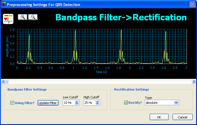 blog_ecg_2.png