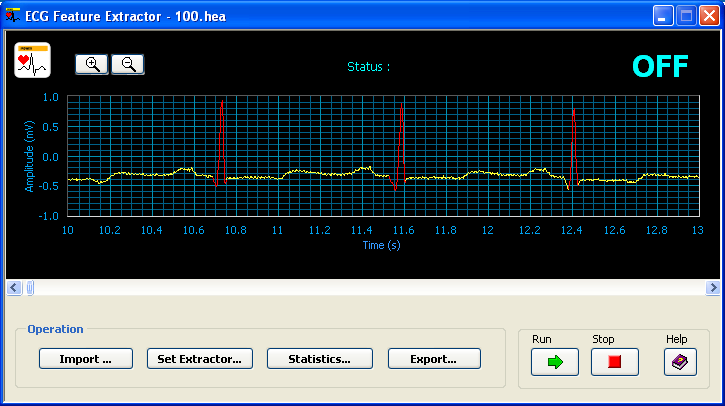 blog_ecg_4.png