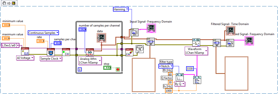 ECG Block Diagram.png