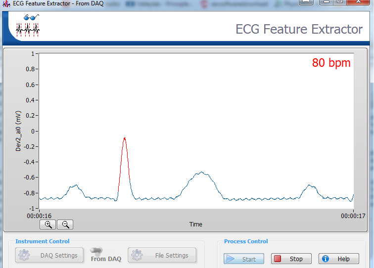 heart rate detection from biomedical tool kit.png