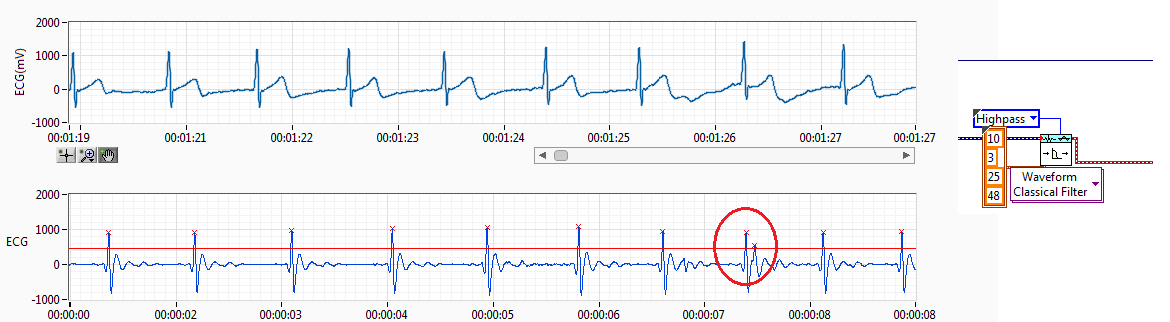 filterECG.png