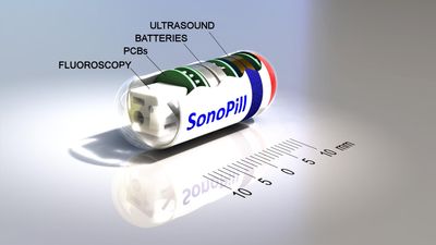 SonoPill Straight Measure ADJ3 Txt Edited.jpg