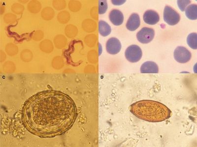 Dividing forms of T. brucei (A) and ring form of P. falciparum (B) in peripheral blood film, ×1000 magnification. Corticated A. lumbricoides ovum (C) and T. trichiura ovum (D) in stool, ×400 magnification